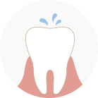牙齦與牙齒分開，有牙周囊袋形成、吃冷吃熱開始酸軟無力