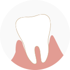 牙齦腫脹與齒槽骨破壞、牙齒鬆動、牙周病形成